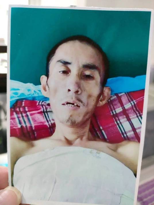 李四强（先天性智力缺陷者）