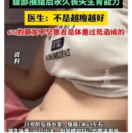 女孩抽脂致卵巢萎缩事件