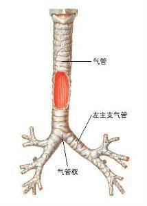 气管切除术