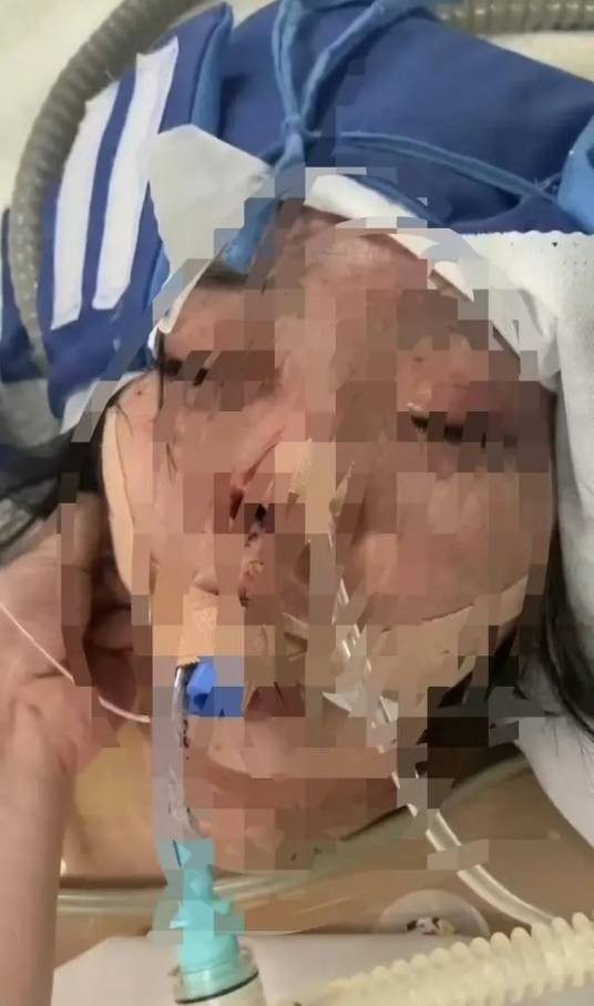 3·19内蒙女子遭家暴事件