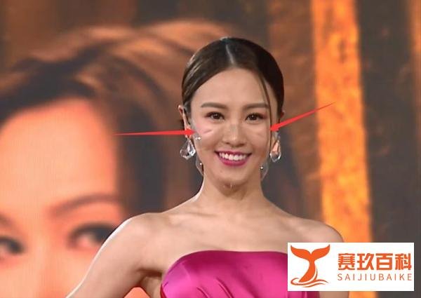 TVB颁奖礼：艺人戴透明口罩起雾还卡肉，视后被嘲“水后”