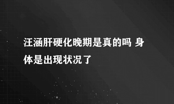 汪涵肝硬化晚期是真的吗 身体是出现状况了