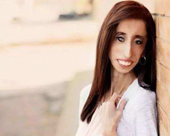 世界上最丑女人的介绍