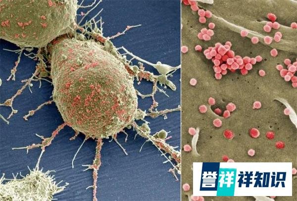张煜再发文质疑卫健委专家团 希望全国公开辩论“肿瘤治疗事件”