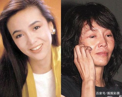 整容的风险很高,都有哪些明星因整容失败而毁容呢?