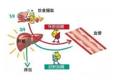 高油三脂和尿酸也高了该怎么办？