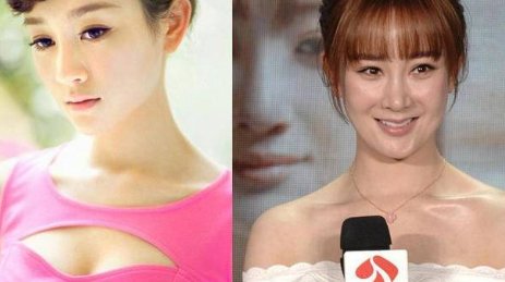 整容的风险很高，都有哪些明星因整容失败而毁容呢？
