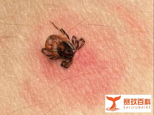艾薇儿和比伯被蜱虫叮咬，养宠物、野外活动的人要小心