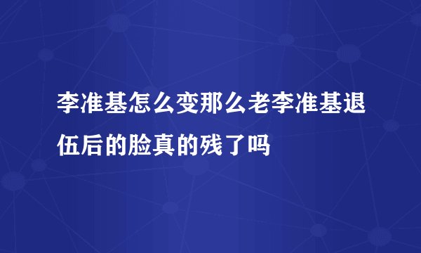 李准基怎么变那么老李准基退伍后的脸真的残了吗