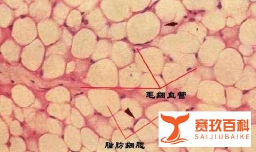 圣嘉新李春财（李朕）科普：自体脂肪丰胸能维持多久？