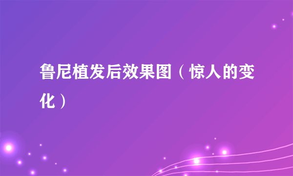 鲁尼植发后效果图（惊人的变化）