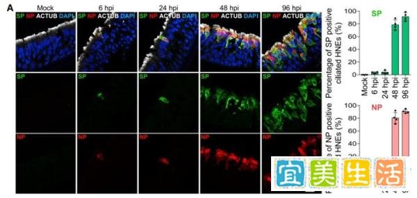 首次解析！Cell: 斯坦福科学家利用类器官精准定位新冠病毒进出鼻腔细胞的途径