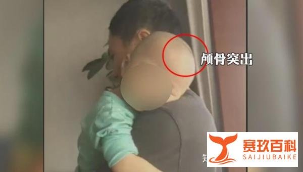 青岛再现大头娃娃,或因使用抑菌膏!宝宝头围需在这个范围更安全