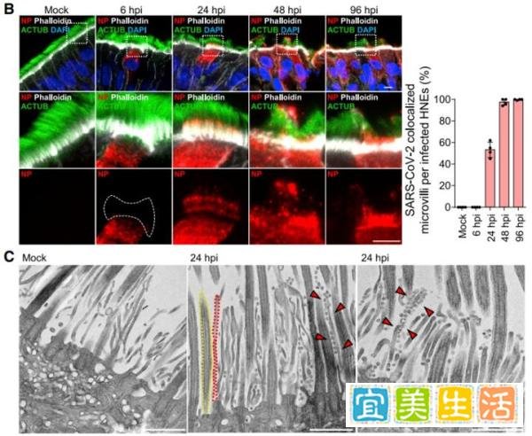 首次解析!Cell: 斯坦福科学家利用类器官精准定位新冠病毒进出鼻腔细胞的途径