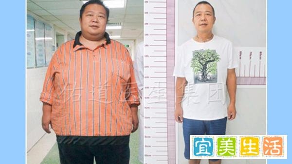 广西第一胖成功减重300斤！还带母亲来减肥！