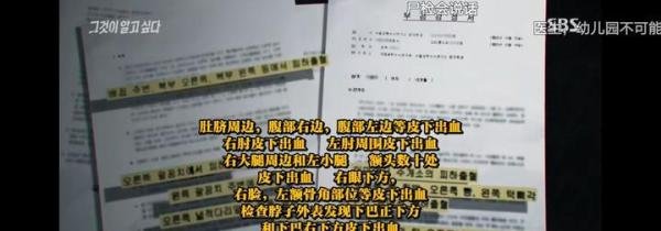 韩国郑仁虐童事件