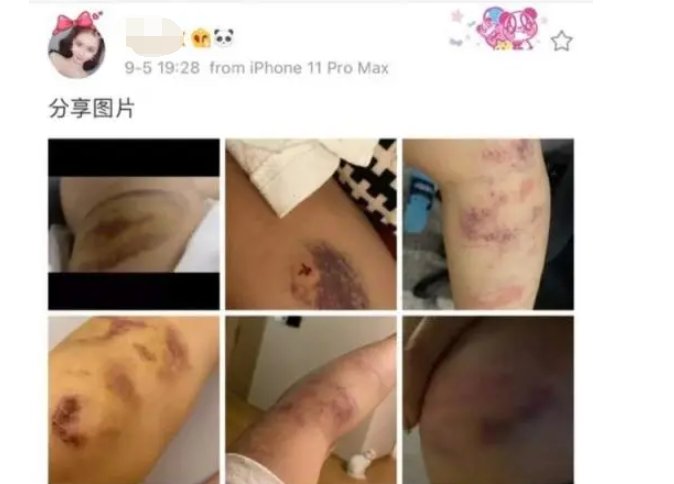 死亡宣告女友放出家暴实锤？