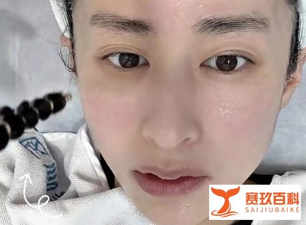 热玛吉：抗衰界的“网红”，为何让明星们如此痴迷？