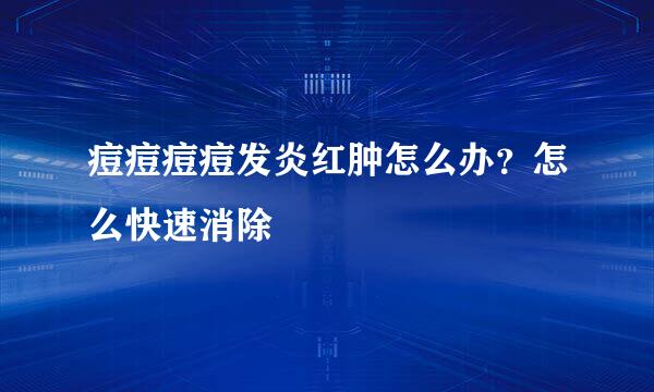 痘痘痘痘发炎红肿怎么办？怎么快速消除