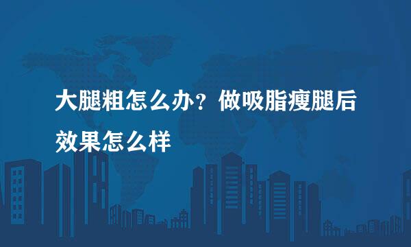 大腿粗怎么办?做吸脂瘦腿后效果怎么样