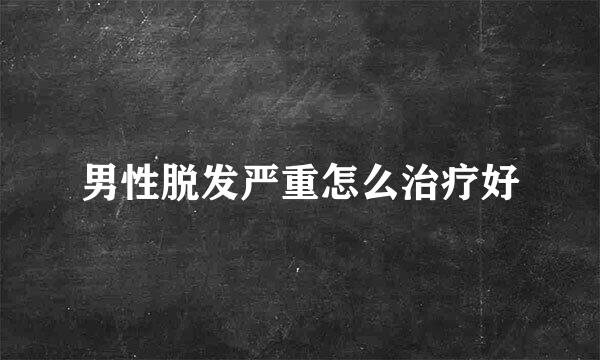 男性脱发严重怎么治疗好
