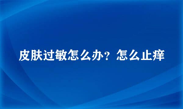 皮肤过敏怎么办？怎么止痒