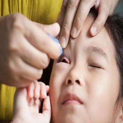 小孩过敏性结膜炎的症状有哪些  小孩过敏性结膜炎的四个症状典型