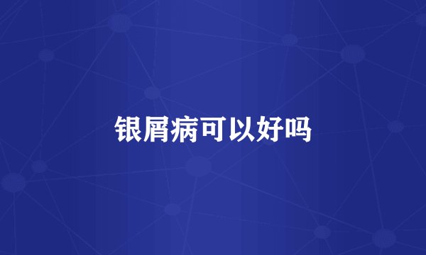 银屑病可以好吗