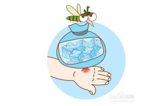 被恙螨咬了怎么处理?