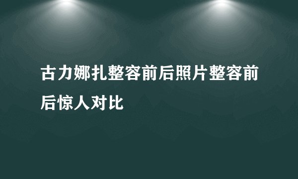 古力娜扎整容前后照片整容前后惊人对比