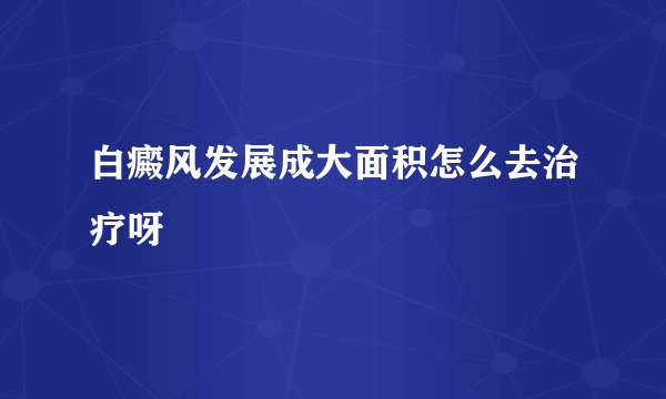白癜风发展成大面积怎么去治疗呀