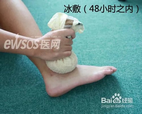 脚扭伤