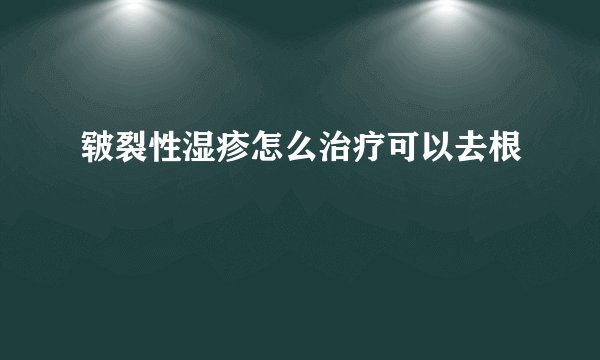 皲裂性湿疹怎么治疗可以去根