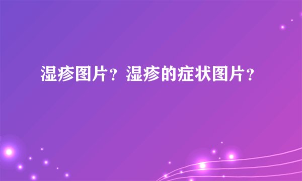 湿疹图片？湿疹的症状图片？
