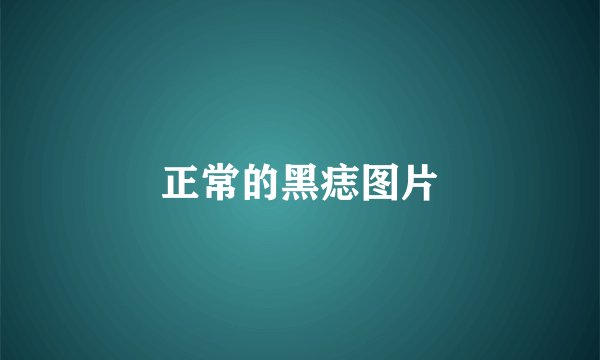 正常的黑痣图片