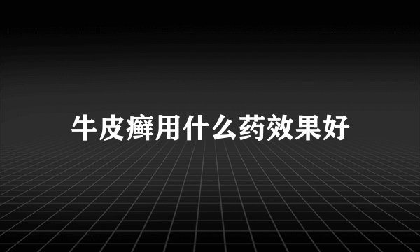 牛皮癣用什么药效果好