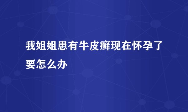 我姐姐患有牛皮癣现在怀孕了要怎么办