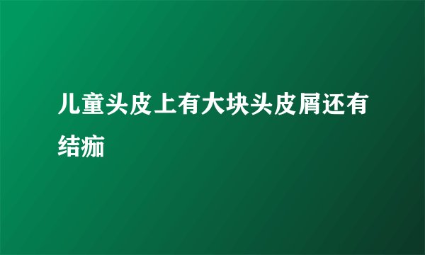 儿童头皮上有大块头皮屑还有结痂