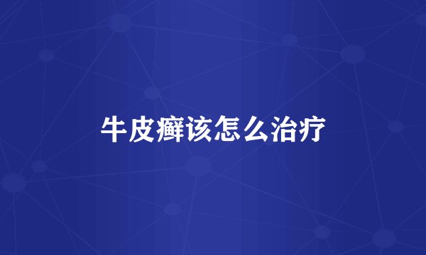 牛皮癣该怎么治疗