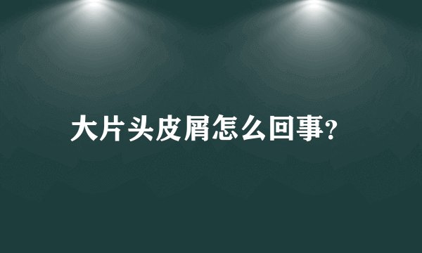 大片头皮屑怎么回事？