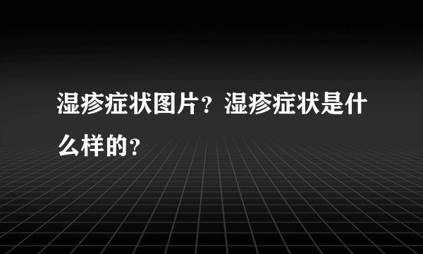 湿疹症状图片？湿疹症状是什么样的？
