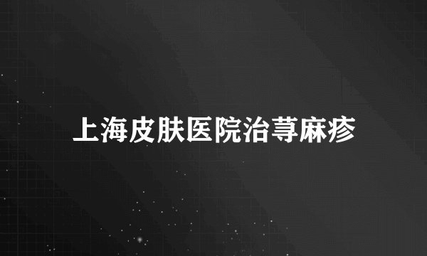 上海皮肤医院治荨麻疹