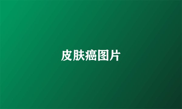 皮肤癌图片