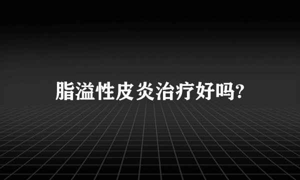 脂溢性皮炎治疗好吗?