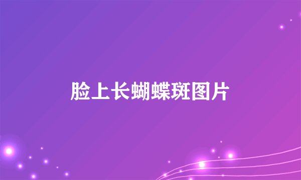 脸上长蝴蝶斑图片
