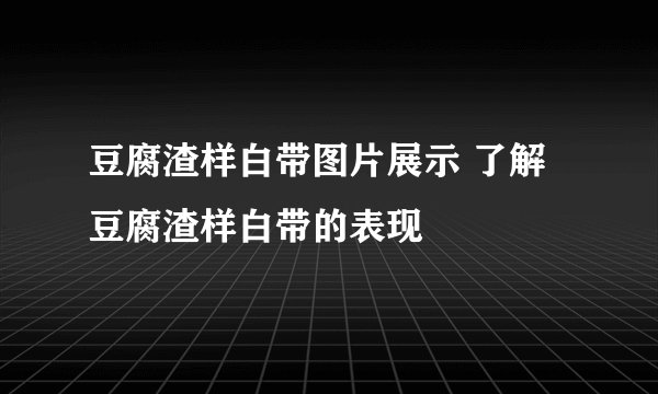 豆腐渣样白带图片展示 了解豆腐渣样白带的表现