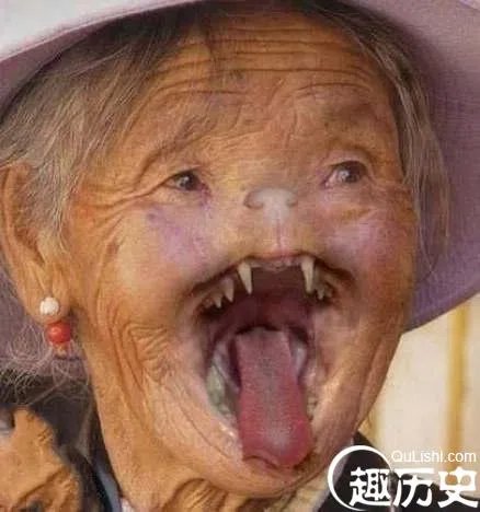揭秘:哈尔滨猫脸老太太事件真相是什么?