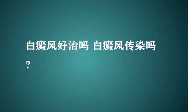 白癜风好治吗 白癜风传染吗？