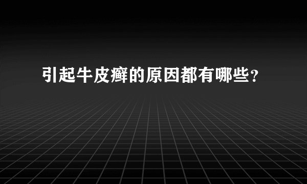 引起牛皮癣的原因都有哪些？
