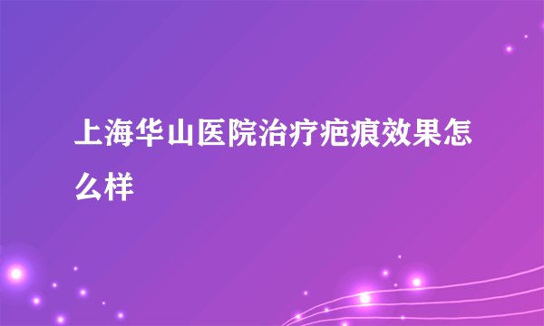 上海华山医院治疗疤痕效果怎么样